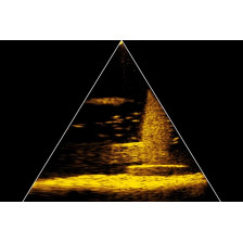 Echosonda Lowrance EAGLE EYE 9 LIVE NOWOŚĆ 2024r.